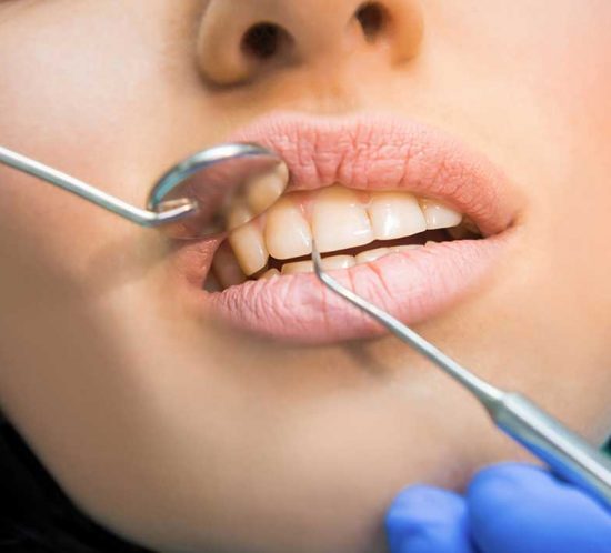 ¿Qué es el trismus o trismo dental? - Clínica Dental Prodental Santa Cruz